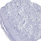 Immunohistochemical staining of human Skin shows no positivity in squamous epithelial cells as expected.