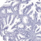 Immunohistochemical staining of human Prostate shows no positivity in glandular cells as expected.