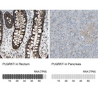 Anti-PLGRKT Antibody