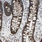 Immunohistochemical staining of human rectum shows high expression.