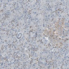 Anti-PLGRKT Antibody