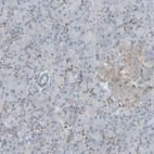 Immunohistochemical staining of human pancreas shows low expression as expected.