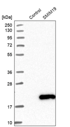 Western blot analysis in control (vector only transfected HEK293T lysate) and SMIM19 over-expression lysate (Co-expressed with a C-terminal myc-DDK tag (~3.1 kDa) in mammalian HEK293T cells, LY408691).