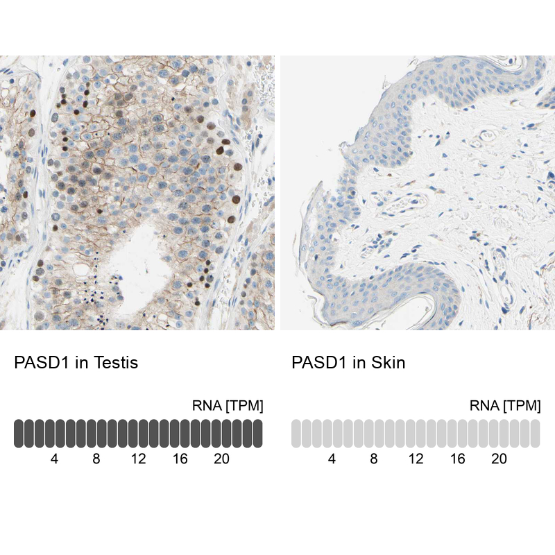 Anti-PASD1 Antibody