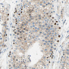 Immunohistochemical staining of human testis shows moderate nuclear positivity in cells in seminiferous ducts.
