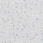 Immunohistochemical staining of human cerebral cortex shows no positivity in neurons as expected.