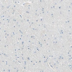 Immunohistochemical staining of human cerebral cortex shows no positivity in neurons as expected.