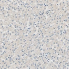 Immunohistochemical staining of human liver shows no positivity in hepatocytes as expected.