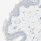 Immunohistochemical staining of human skin shows no positivity in squamous epithelial cells as expected.
