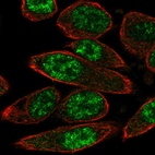 Immunofluorescent staining of human cell line PC-3 shows localization to nuclear speckles.