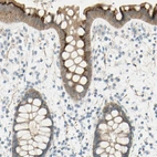 Immunohistochemical staining of human rectum shows high expression.