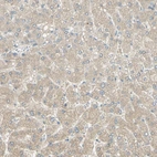 Immunohistochemical staining of human liver shows low expression as expected.