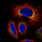 Immunofluorescent staining of human cell line A549 shows localization to the Golgi apparatus.