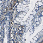 Immunohistochemical staining of human colon shows moderate to strong membranous positivity in lymphoid cells.