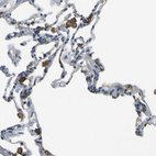 Immunohistochemical staining of human lung shows strong membranous positivity in macrophages.