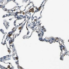 Immunohistochemical staining of human lung shows strong membranous positivity in macrophages.