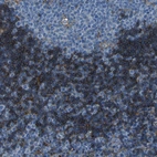 Immunohistochemical staining of human lymph node shows strong membranous positivity in non-germinal center cells.