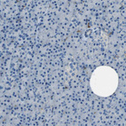 Anti-LAIR1 Antibody