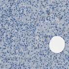 Immunohistochemical staining of human pancreas shows no positivity in exocrine glandular cells as expected.
