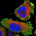 Immunofluorescent staining of human cell line U-251 MG shows localization to plasma membrane.