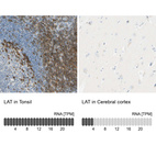 Anti-LAT Antibody