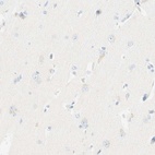 Anti-LAT Antibody