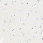 Immunohistochemical staining of human cerebral cortex shows low expression as expected.