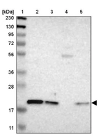 Lane 1: Marker [kDa] 230, 130, 95, 72, 56, 36, 28, 17, 11_br/_Lane 2: Human cell line RT-4_br/_Lane 3: Human cell line U-251MG sp_br/_Lane 4: Human plasma (IgG/HSA depleted)_br/_Lane 5: Human liver tissue