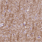 Anti-SIRT2 Antibody