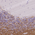 Anti-SIRT2 Antibody