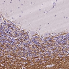 Immunohistochemical staining of human cerebellum shows moderate cytoplasmic positivity in oligodendrocytes.
