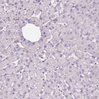 Anti-SIRT2 Antibody