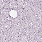 Immunohistochemical staining of human liver shows no positivity in hepatocytes as expected.