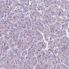 Anti-SIRT2 Antibody