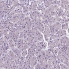 Immunohistochemical staining of human pancreas shows no positivity in exocrine glandular cells as expected.