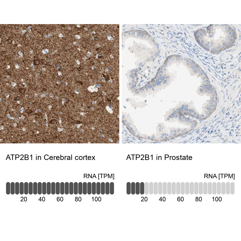Anti-ATP2B1 Antibody