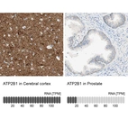 Anti-ATP2B1 Antibody