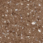 Immunohistochemical staining of human cerebral cortex shows strong cytoplasmic positivity in neuronal cells and neuropils.