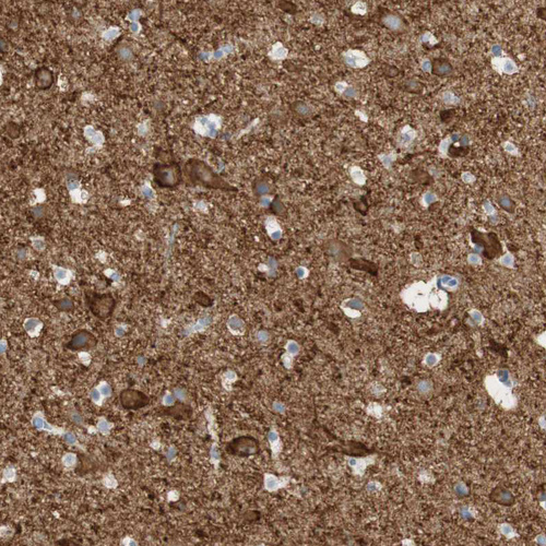 Anti-ATP2B1 Antibody