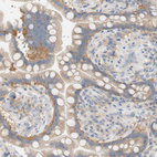 Immunohistochemical staining of human colon shows moderate cytoplasmic positivity in glandular cells.