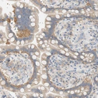 Immunohistochemical staining of human colon shows moderate cytoplasmic positivity in glandular cells.