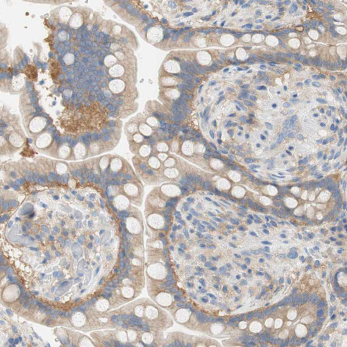 Anti-ATP2B1 Antibody