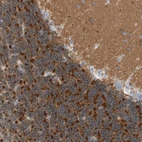 Immunohistochemical staining of human cerebellum shows strong cytoplasmic positivity in glia and interneurons cells.