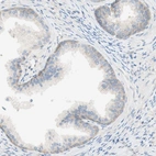 Immunohistochemical staining of human prostate shows negative cytoplasmic positivity in glandular cells as expected.