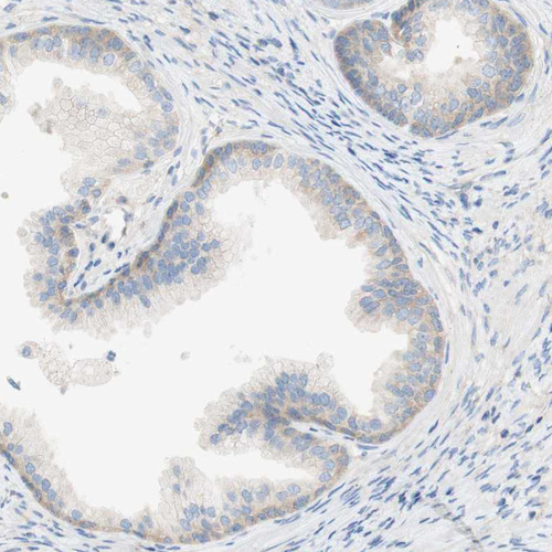 Anti-ATP2B1 Antibody