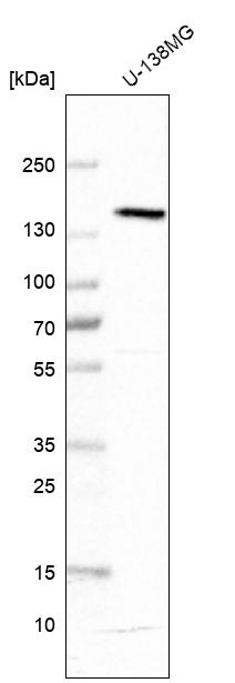 Anti-ATP2B1 Antibody