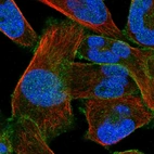 Immunofluorescent staining of human cell line RH-30 shows localization to nucleus & plasma membrane.