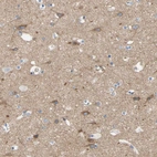 Immunohistochemical staining of human cerebral cortex shows moderate cytoplasmic positivity in neurons and neuropil.