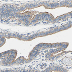 Immunohistochemical staining of human fallopian tube shows moderate cytoplasmic positivity in glandular cells.