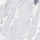Immunohistochemical staining of human skeletal muscle shows no in myocytes as expected.